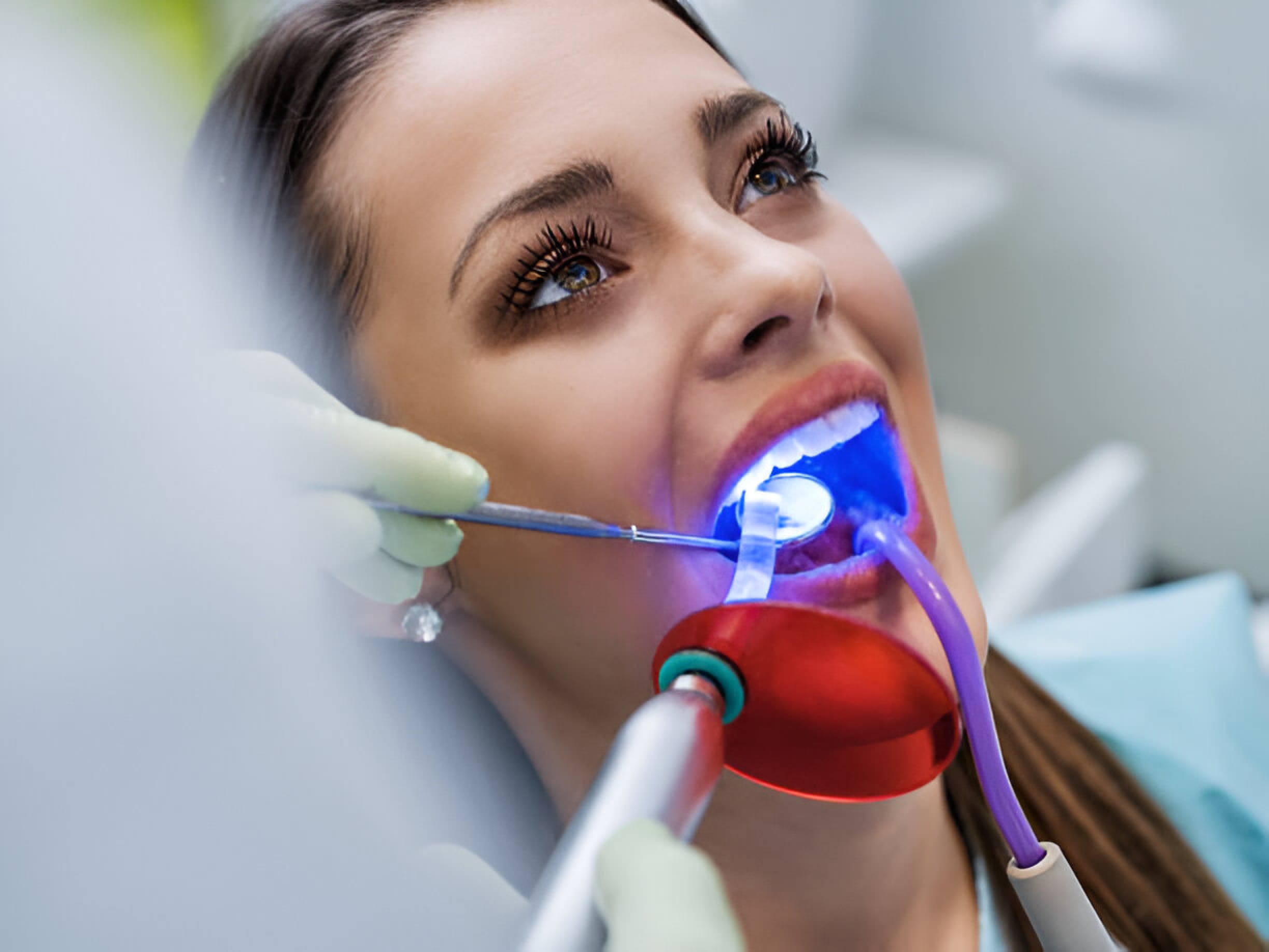 laser dentistry edmonton