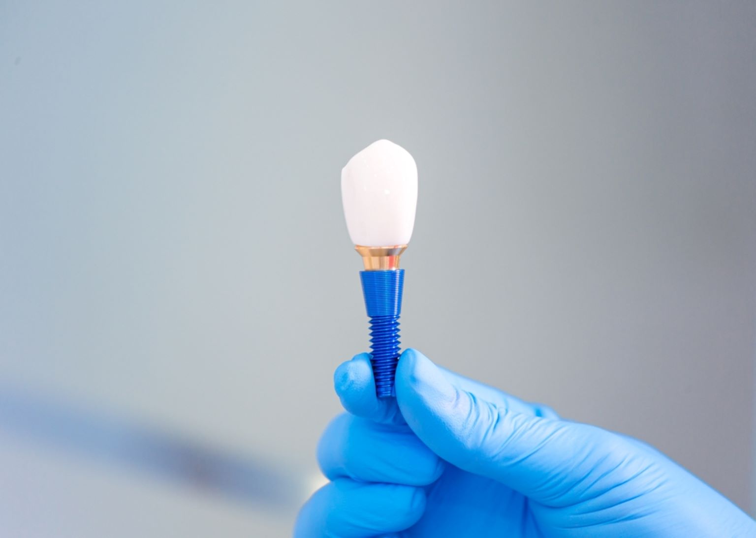 Do Dental Implants Look Natural? | Whyte Ave Dental Choice